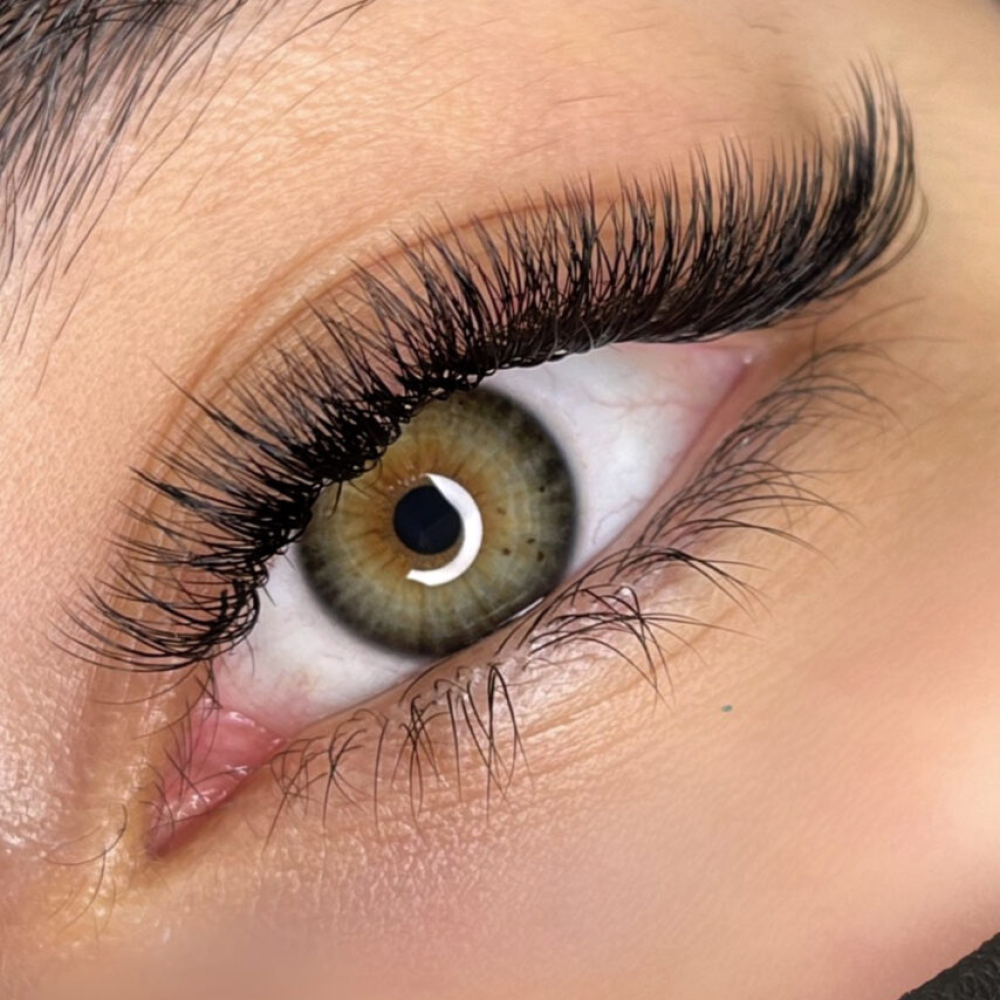 eyelash-transplant